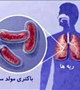 به بهانه 23  مهرماه روز ملی مبارزه با سل / آنچه در مورد  این بیماری باید بدانیم  