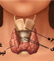 برگزاری جلسه بررسی وضعیت هیپوتیروئیدی، در معاونت بهداشتی