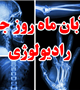 هفدهم آبان ماه ( ٨ نوامبر) ،  روز جهانى رادیولوژى گرامی باد 